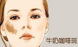 影响外貌